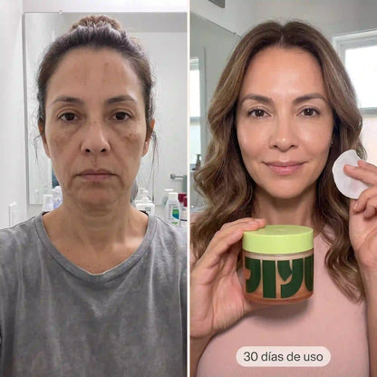 Glow Coreano 8 en 1™ — Almohadillas Anti-Manchas, Acné y Arrugas